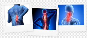 Back Pain PNG Transparent Images Download